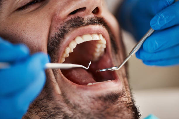 Best Emergency Dentist for Knocked-Out Tooth in Glen Ellyn, IL